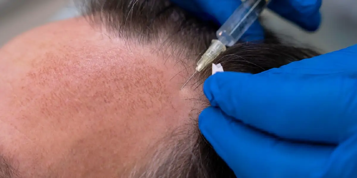 Hair Restoration