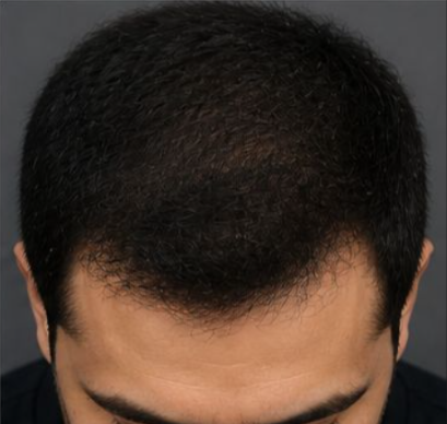After