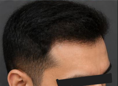 After